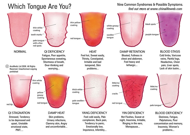 TCM Tongue Diagnosis Cinnabar Acupuncture Blog